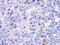 Intraflagellar Transport 122 antibody, GTX119175, GeneTex, Immunohistochemistry paraffin image 