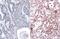 KRAS Proto-Oncogene, GTPase antibody, GTX635623, GeneTex, Immunohistochemistry paraffin image 