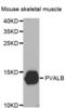 Parvalbumin antibody, abx002095, Abbexa, Western Blot image 