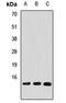 Coactosin Like F-Actin Binding Protein 1 antibody, LS-C668521, Lifespan Biosciences, Western Blot image 