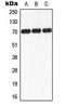 Ribosomal Protein S6 Kinase B1 antibody, LS-C354084, Lifespan Biosciences, Western Blot image 