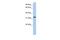 Family With Sequence Similarity 216 Member A antibody, PA5-44240, Invitrogen Antibodies, Western Blot image 