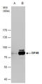 Eukaryotic Translation Initiation Factor 4B antibody, GTX112612, GeneTex, Western Blot image 