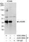 Lin-28 Homolog B antibody, A303-589A, Bethyl Labs, Immunoprecipitation image 