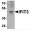 Interferon-induced protein with tetratricopeptide repeats 3 antibody, TA349042, Origene, Western Blot image 