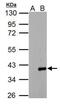 Actin Related Protein 2/3 Complex Subunit 1A antibody, PA5-78331, Invitrogen Antibodies, Western Blot image 