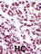 Protein Kinase C Epsilon antibody, abx033117, Abbexa, Western Blot image 