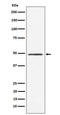 Cleavage And Polyadenylation Factor I Subunit 1 antibody, M02473-1, Boster Biological Technology, Western Blot image 