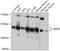 RNA Binding Motif Protein 5 antibody, 13-803, ProSci, Western Blot image 