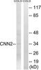 Calponin 2 antibody, TA312947, Origene, Western Blot image 