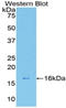 Galectin 7B antibody, LS-C302362, Lifespan Biosciences, Western Blot image 