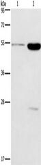 GABA(A) receptor subunit gamma-2 antibody, TA351206, Origene, Western Blot image 