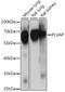 Plasmalemma Vesicle Associated Protein antibody, A15906, ABclonal Technology, Western Blot image 