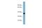 Acyl-CoA Synthetase Medium Chain Family Member 2A antibody, A11795, Boster Biological Technology, Western Blot image 