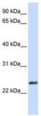 Endogenous Retrovirus Group W Member 1, Envelope antibody, TA341944, Origene, Western Blot image 