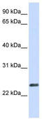 Syncytin antibody, TA341944, Origene, Western Blot image 