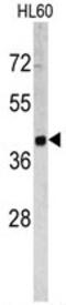 Tumor Associated Calcium Signal Transducer 2 antibody, AP17808PU-N, Origene, Western Blot image 