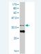 HIC ZBTB Transcriptional Repressor 1 antibody, H00003090-M05, Novus Biologicals, Western Blot image 