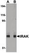 Interleukin 1 Receptor Associated Kinase 1 antibody, LS-C144494, Lifespan Biosciences, Western Blot image 