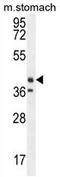 Tectorin Beta antibody, AP54215PU-N, Origene, Western Blot image 