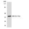 Olfactory Receptor Family 1 Subfamily S Member 1 (Gene/Pseudogene) antibody, LS-C200330, Lifespan Biosciences, Western Blot image 