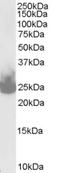 Synaptosome Associated Protein 25 antibody, EB06738, Everest Biotech, Western Blot image 