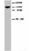 Neural Cell Adhesion Molecule 1 antibody, LS-C171792, Lifespan Biosciences, Western Blot image 