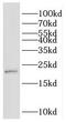 Gastrokine-1 antibody, FNab03356, FineTest, Western Blot image 