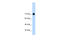 GTF2I Repeat Domain Containing 1 antibody, 29-033, ProSci, Western Blot image 