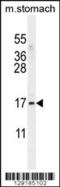 Zinc Finger Protein 428 antibody, 56-044, ProSci, Western Blot image 