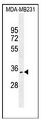 OTU Deubiquitinase 6A antibody, AP53133PU-N, Origene, Western Blot image 