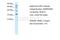 Cyclin Dependent Kinase 7 antibody, 31-031, ProSci, Immunohistochemistry paraffin image 