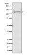 Transforming Growth Factor Beta Induced antibody, M01218-1, Boster Biological Technology, Western Blot image 