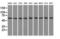 ATP Synthase F1 Subunit Beta antibody, LS-C114910, Lifespan Biosciences, Western Blot image 
