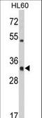 Major Histocompatibility Complex, Class II, DR Alpha antibody, LS-C164919, Lifespan Biosciences, Western Blot image 