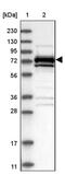 Mitogen-Activated Protein Kinase Kinase Kinase 2 antibody, PA5-54443, Invitrogen Antibodies, Western Blot image 