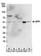 Death-associated protein kinase 3 antibody, A304-221A, Bethyl Labs, Western Blot image 
