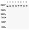 Integrin Subunit Alpha 5 antibody, LS-C357417, Lifespan Biosciences, Western Blot image 