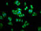 PSA antibody, LS-C673118, Lifespan Biosciences, Immunofluorescence image 