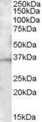 B And T Lymphocyte Associated antibody, GTX88506, GeneTex, Western Blot image 