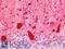 Parvalbumin antibody, LS-B11425, Lifespan Biosciences, Immunohistochemistry frozen image 