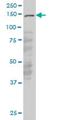 Lemur Tyrosine Kinase 3 antibody, H00114783-M03, Novus Biologicals, Western Blot image 