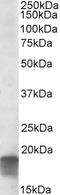 Eukaryotic Translation Initiation Factor 5A antibody, 42-119, ProSci, Western Blot image 