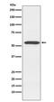 Cytochrome P450 Family 2 Subfamily D Member 6 antibody, M00498, Boster Biological Technology, Western Blot image 