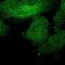 SHOC2 Leucine Rich Repeat Scaffold Protein antibody, NBP1-87831, Novus Biologicals, Immunocytochemistry image 