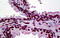 Cyclic AMP-dependent transcription factor ATF-1 antibody, MBS246687, MyBioSource, Immunohistochemistry frozen image 
