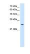 Adenylate Kinase 2 antibody, NBP1-54639, Novus Biologicals, Western Blot image 