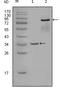 EPH Receptor A7 antibody, M03943, Boster Biological Technology, Western Blot image 