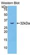 Carboxypeptidase B2 antibody, LS-C296606, Lifespan Biosciences, Western Blot image 