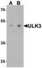 Unc-51 Like Kinase 3 antibody, TA326685, Origene, Western Blot image 